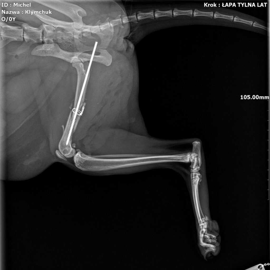 zbyt długi implant zastosowany podczas wcześniejszego zabiegu.